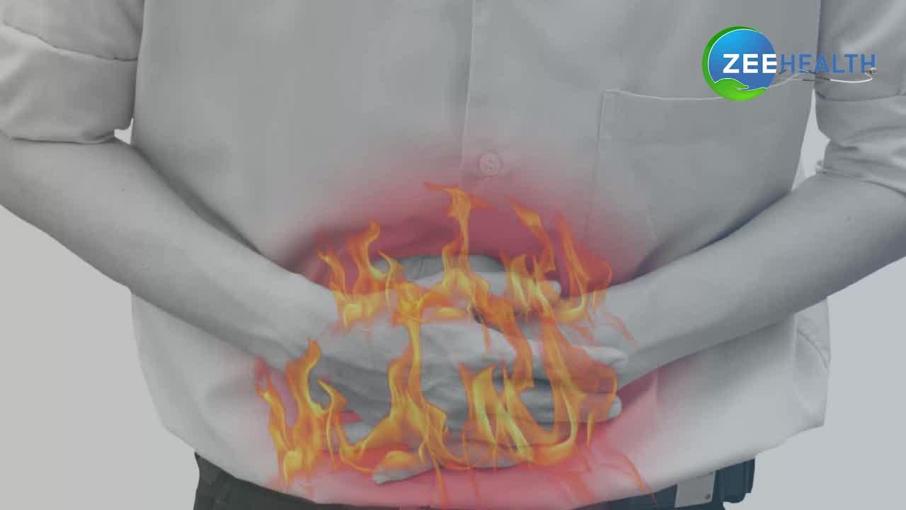 VIDEO: पेट में बनने वाली गैस को हमेशा के लिए खत्म कर देंगे ये 5 उपाय, 1 मिनट में जानिए...