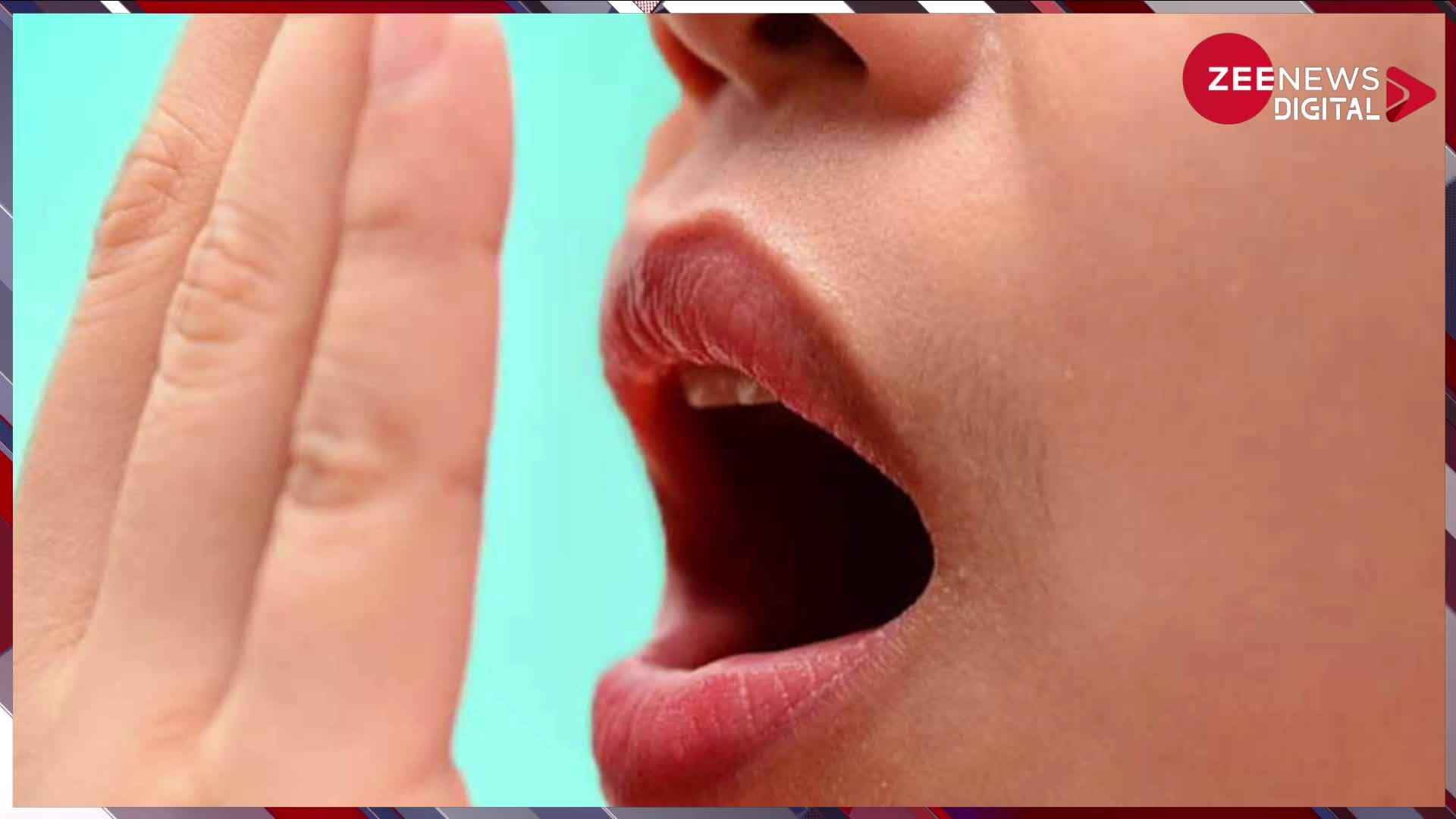 Bad Breath: मुंह की बदबू के कारण होना पड़ता है शर्मिंदा? आज हीअपनाएं ये घरेलू उपाय