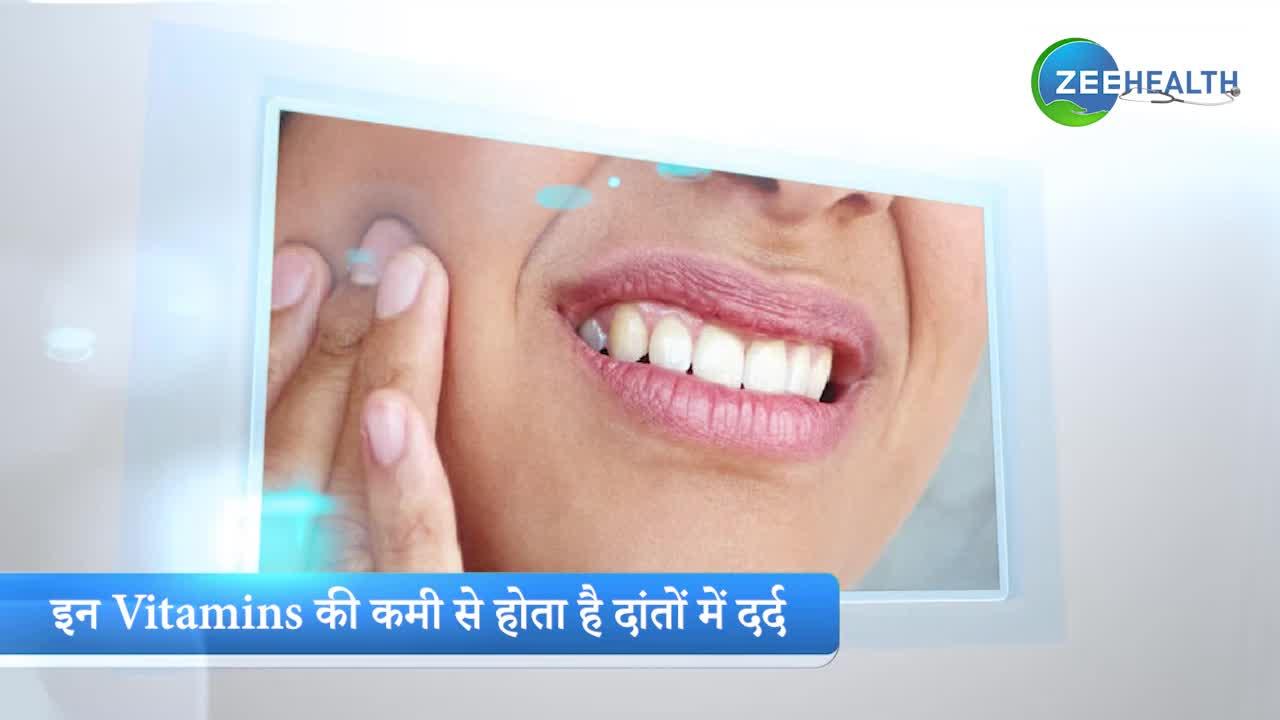 जानिए कौन से Vitamins की कमी से होता है दांतों में दर्द
