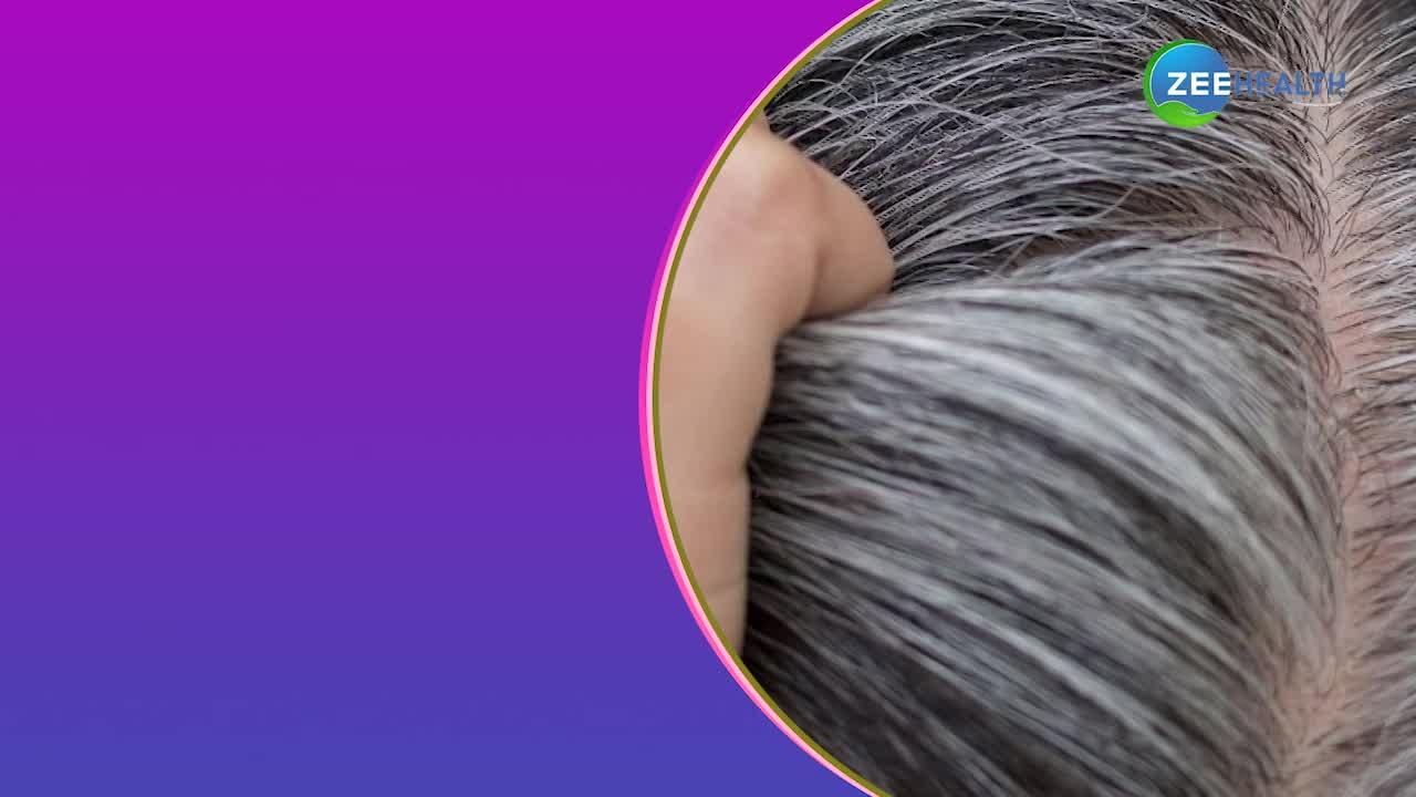 सफेद बालों को काला बनाने का जबरदस्त इलाज, देखें वीडियो