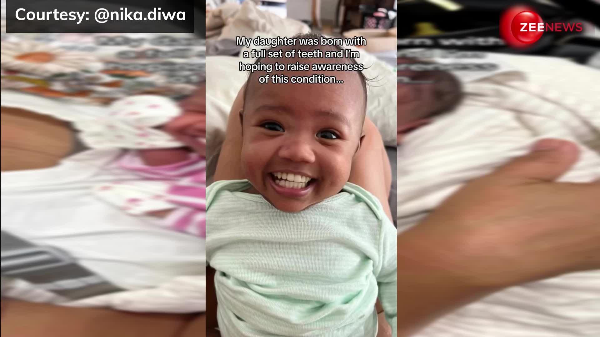 पैदा होते ही दिखे बच्ची के 32 दांत, प्यारी सी smile छू गई लोगों के दिल, वीडियो शेयर कर मां ने कही ये बात