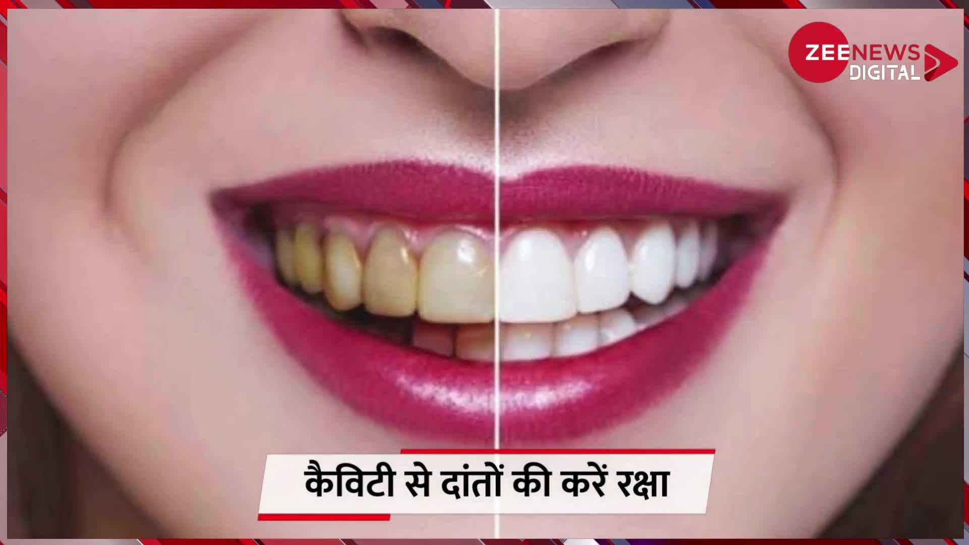Teeth Cavity: दांतों की सड़न की दुश्मन हैं ये चीजें, कैविटी का नहीं रहता कोई निशान