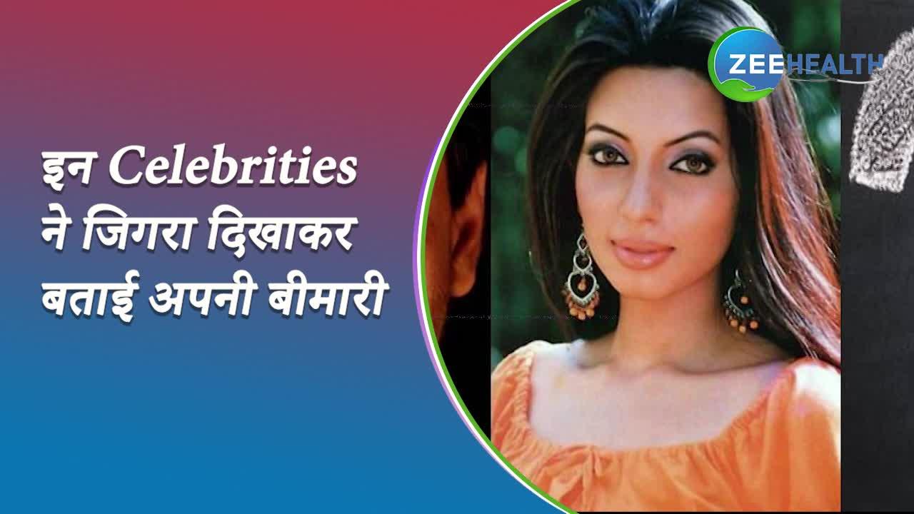 इन Celebrities ने दिखाया जिगरा और अपनी छिपी हुई बीमारी से उठाया पर्दा