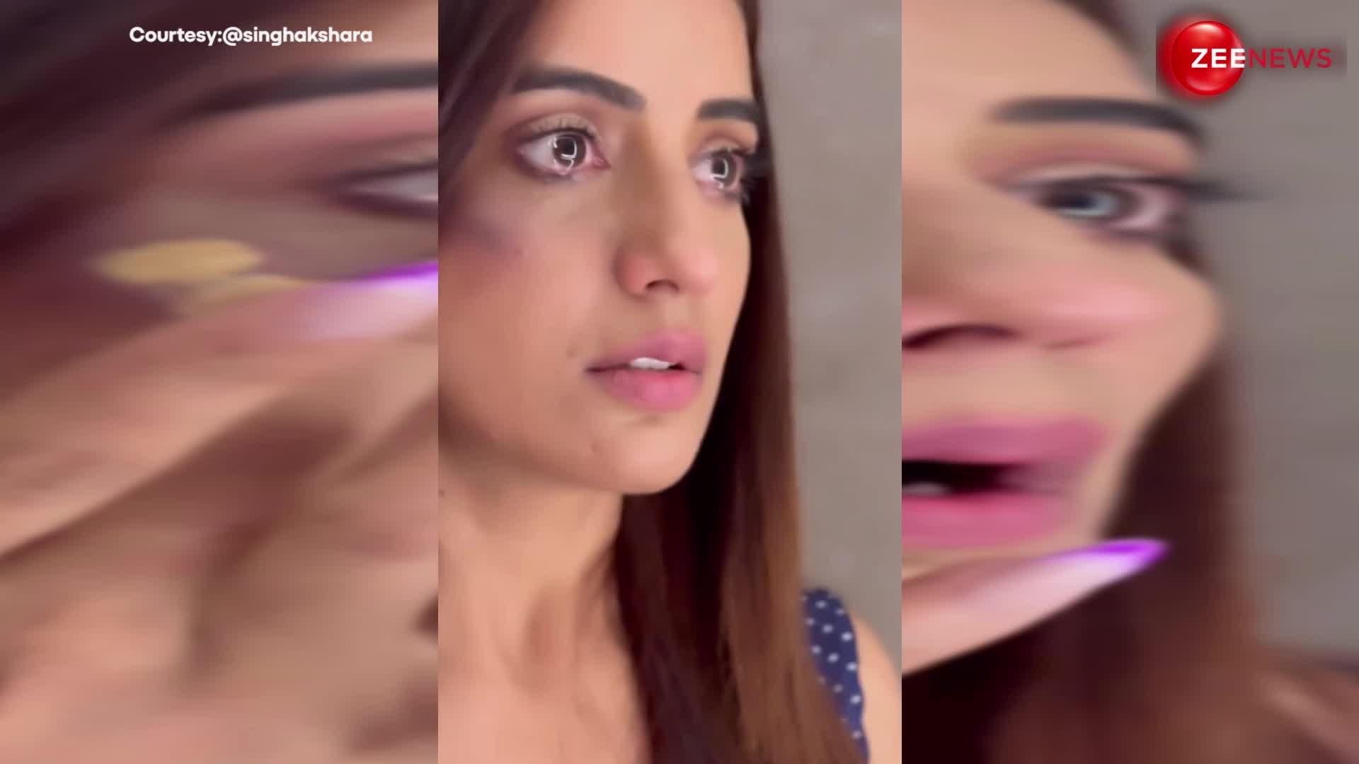 वीडियो में क्यों रो रही हैं Akshara Singh? चेहरे पर चोट का निशान देख चिंता में आए फैंस!